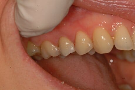 new crown Spot the crown