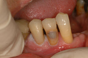 bad-filling bad-filling