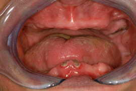 DSCF0046 before treatment