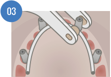 we-weldone-system-03 we-weldone-system-03