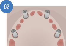 ws-weldone-system-02 ws-weldone-system-02