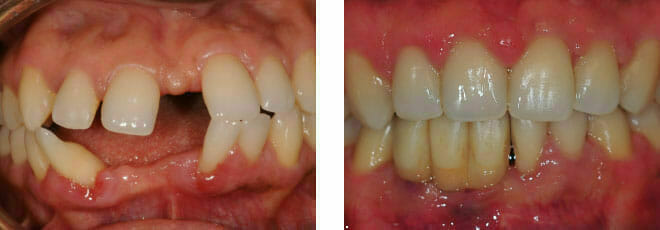 Complex Orthodontics in Romford, Essex | The Art of Dentistry Dental Clinic