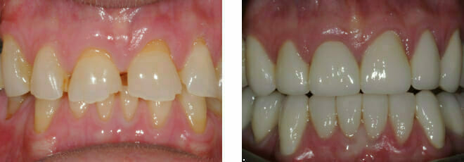 We Simply Listen to your Dental Concerns | Cosmetic Dentistry in Romford, Essex | The Art of Dentistry Dental Clinic