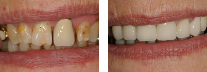 Not Everyone Wants to Look Like Rylan | Cosmetic Dentistry in Romford, Essex | The Art of Dentistry Dental Clinic