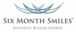 Six Month Smiles | Cosmetic Braces System in Romford, Essex | The Art of Dentistry