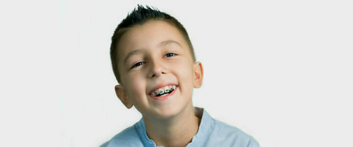 Children Orthodontics in Romford, Essex | The Art of Dentistry Dental Clinic