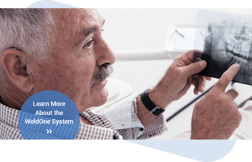 Learn about the WeldOne System in Romford, Essex | The Art of Dentistry Dental Clinic